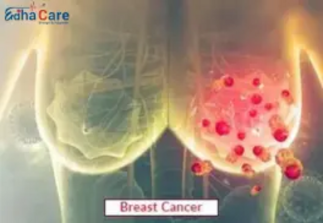 1717656487breast2.png