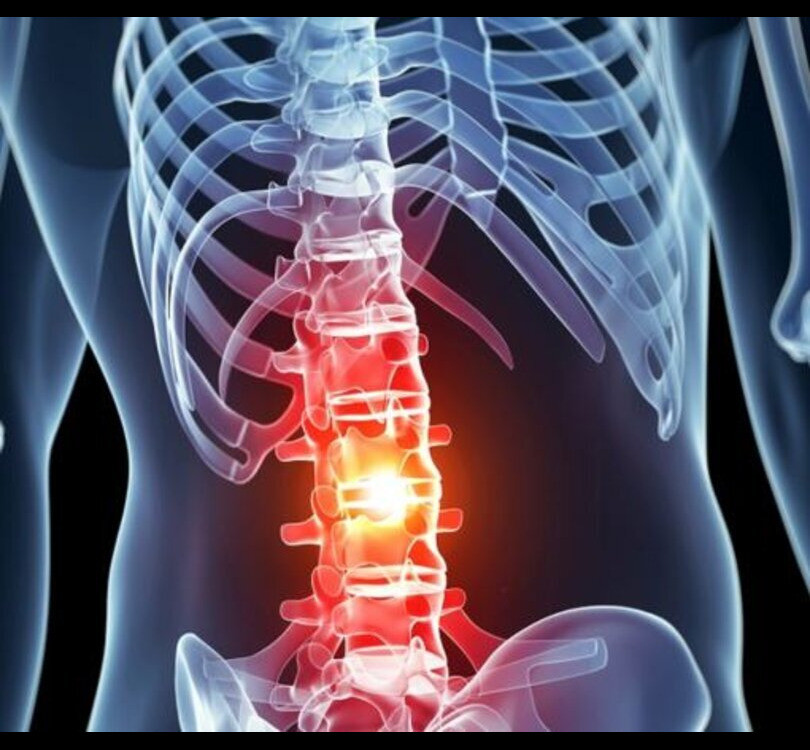 spinalcordinjury1.jpg