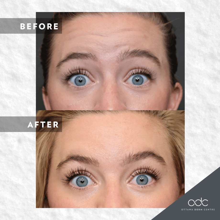 imgi_39_odcbeforeandafter46.jpeg