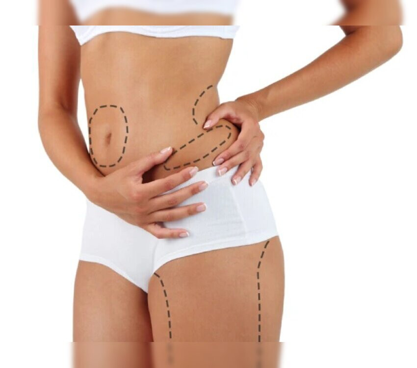 liposuctiontreatmentinnavimumbai1.jpg