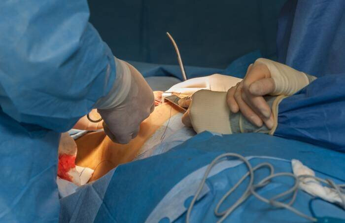 drsiddharthprakashperformingbreastreductionsurgeryinmumbai.jpg
