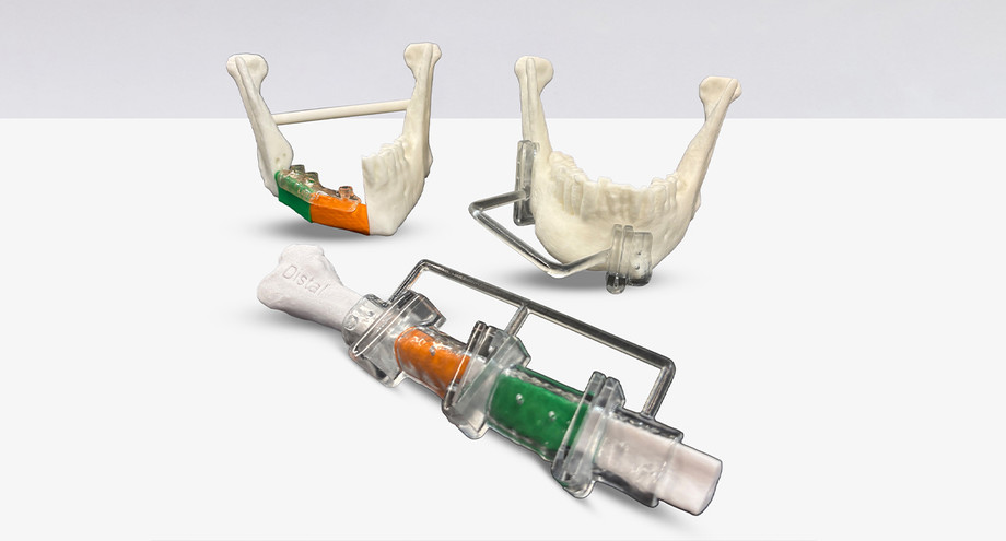 patientspecificdentalsurgicalguidesimplants.jpg