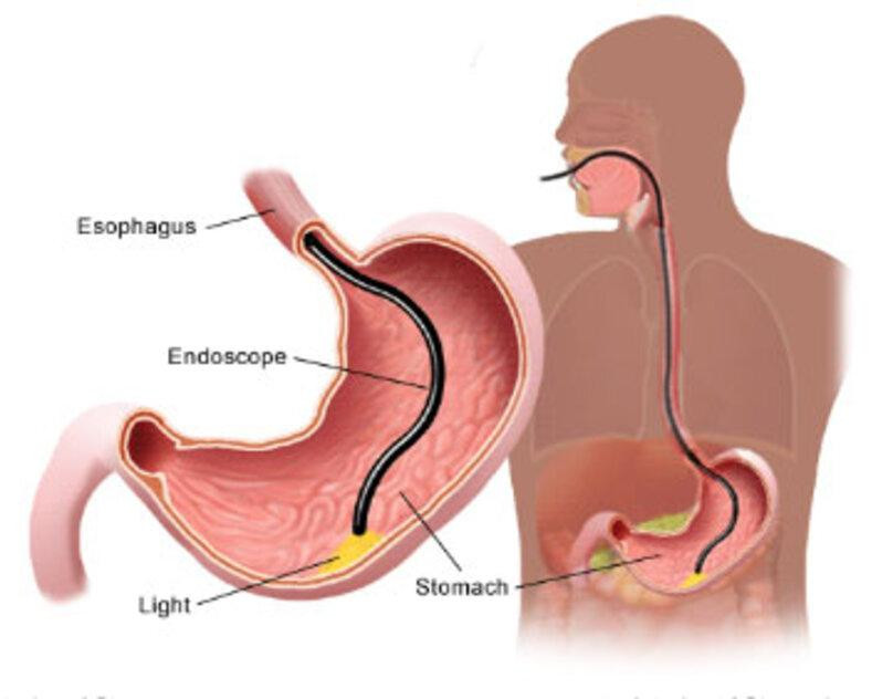 diagnosticuppergi1.jpg