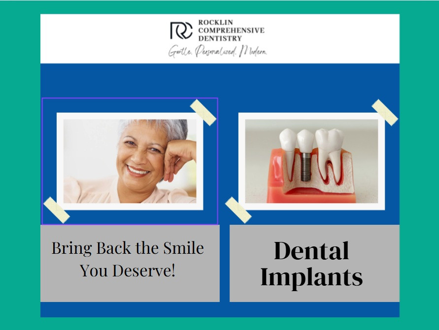 dentalimplantsrocklin.jpg