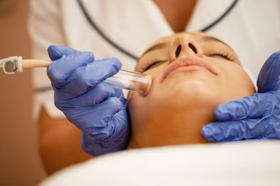 hydrodermabrasiontreatmentportcoquitlam.jpg