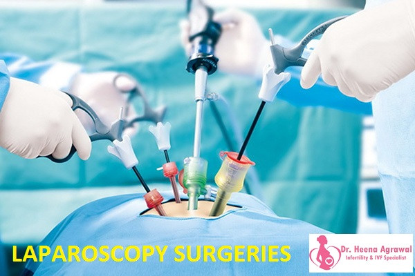 laparoscopysurgeries.jpg