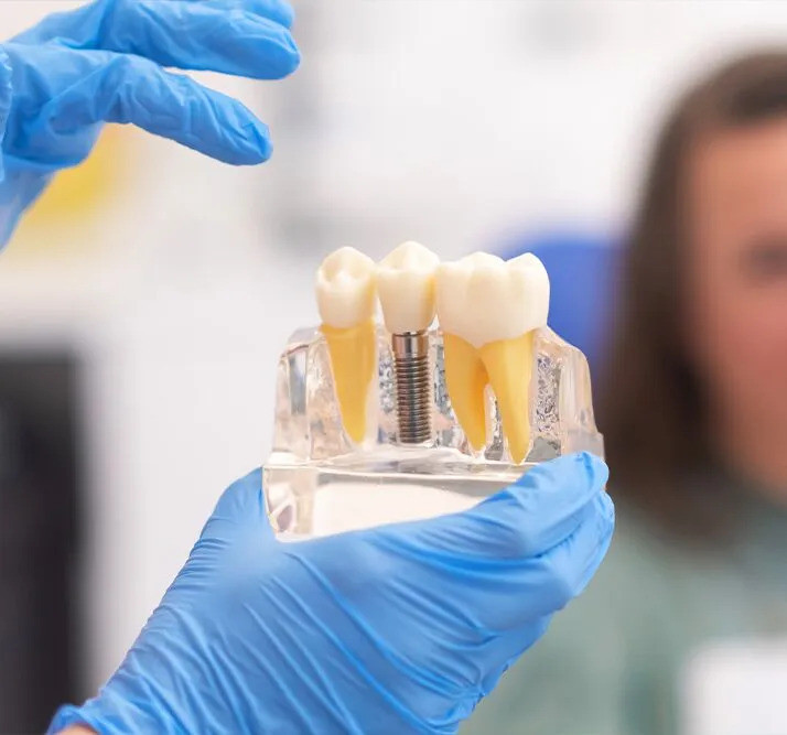 typesofdentalimplantsoffered.jpg