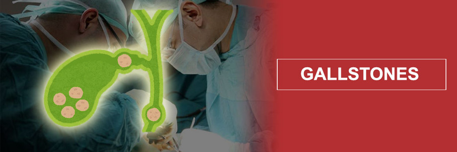 gallstonestreatment.jpg