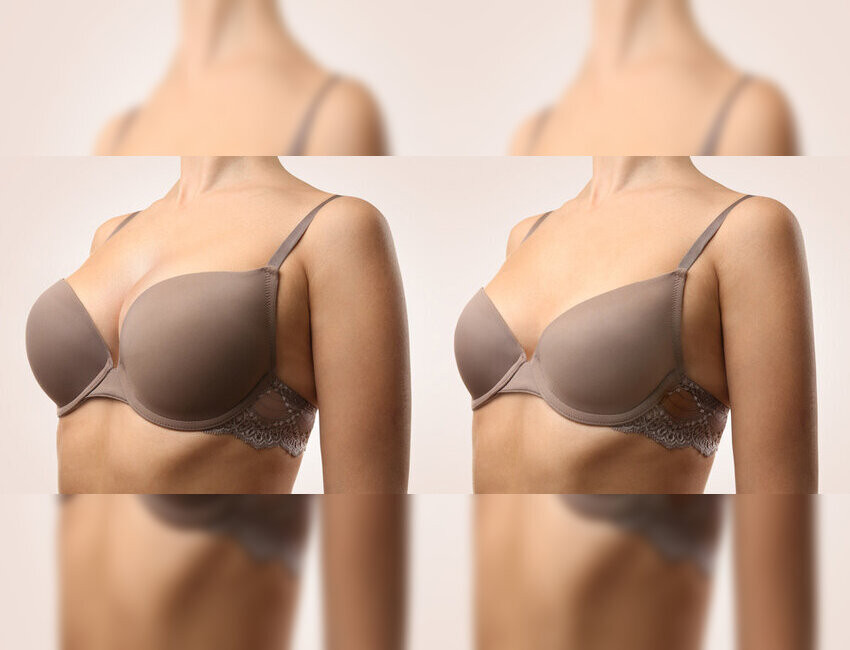 breastaugmentationreduction1.jpg
