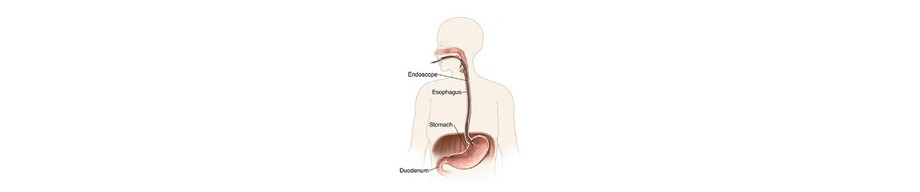 diagnosticuppergi.jpg