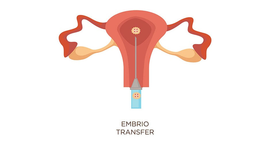 embryotransfer940x501.jpg