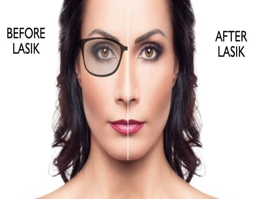 lasik_img441024x576.jpg