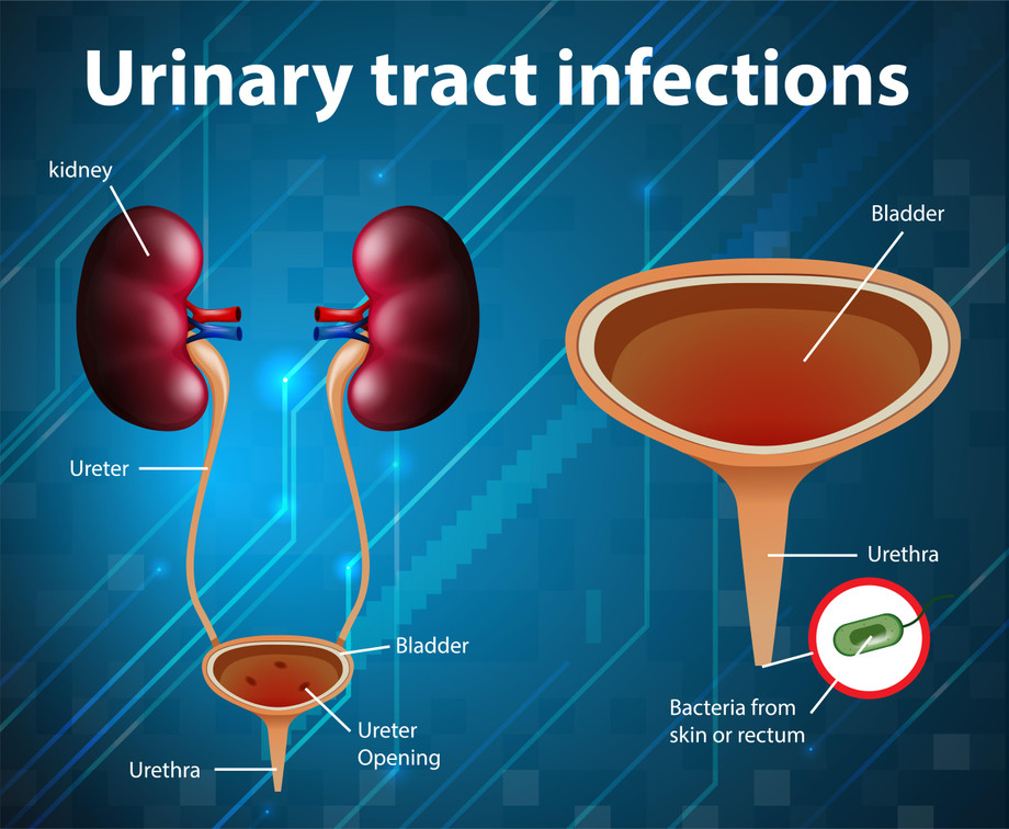 urinarytractinfections.jpg
