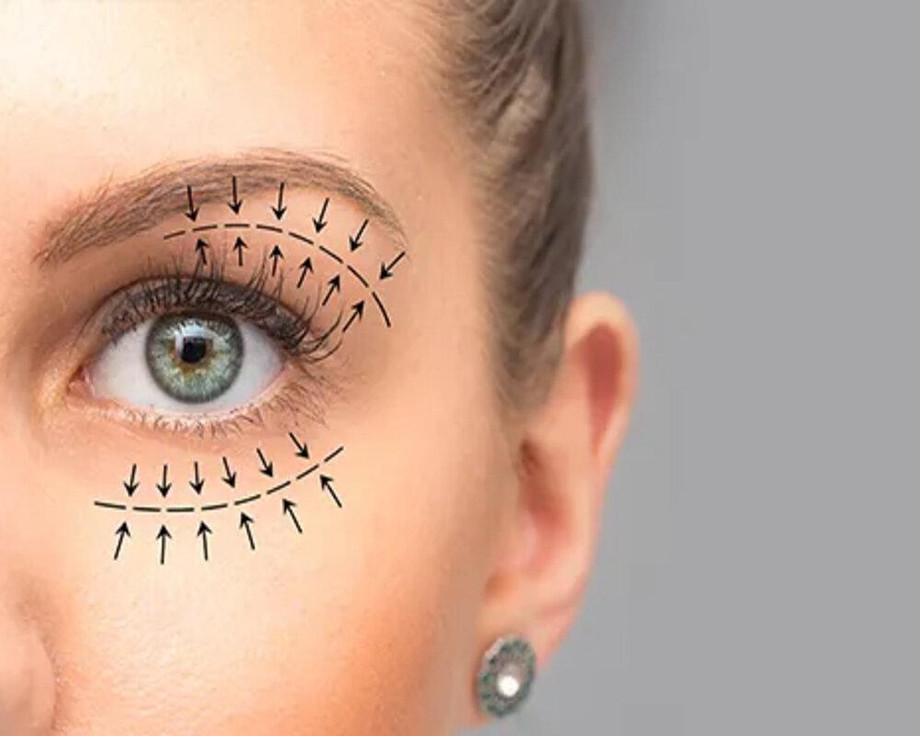 childeyecare31.jpg