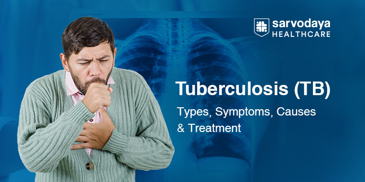 tuberculosis prevention