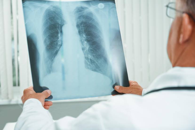 everythingyouneedtoknowaboutxrays.jpg