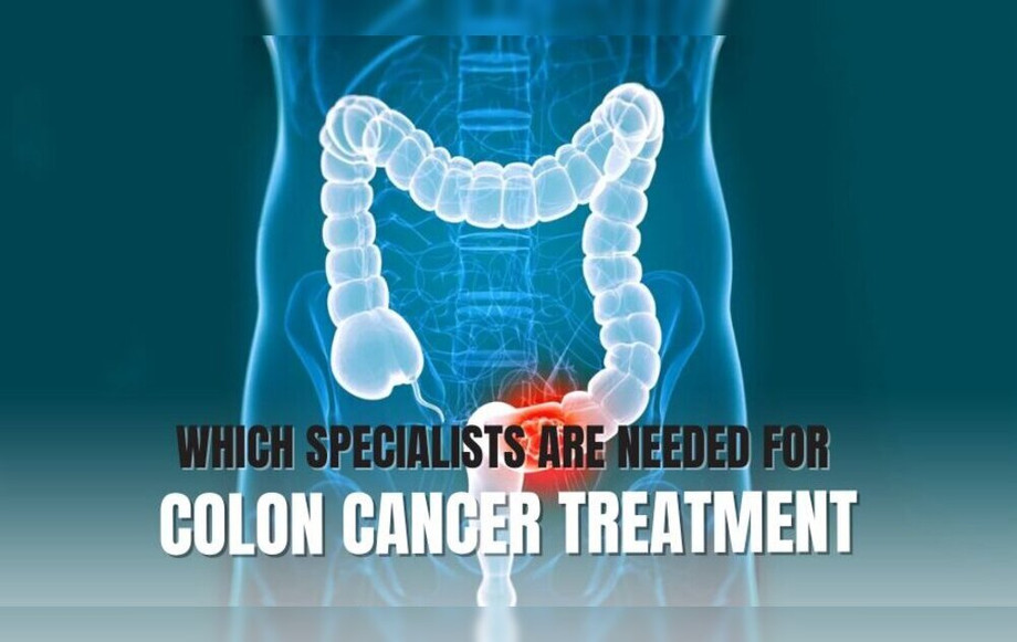 whichspecialistsareneededforcoloncancertreatment.jpg