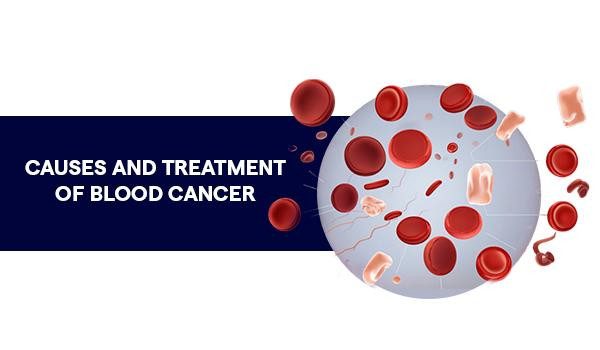 causesandtreatmentofbloodcancer.jpg