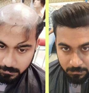 hairweavingserviceinmumbai.jpg
