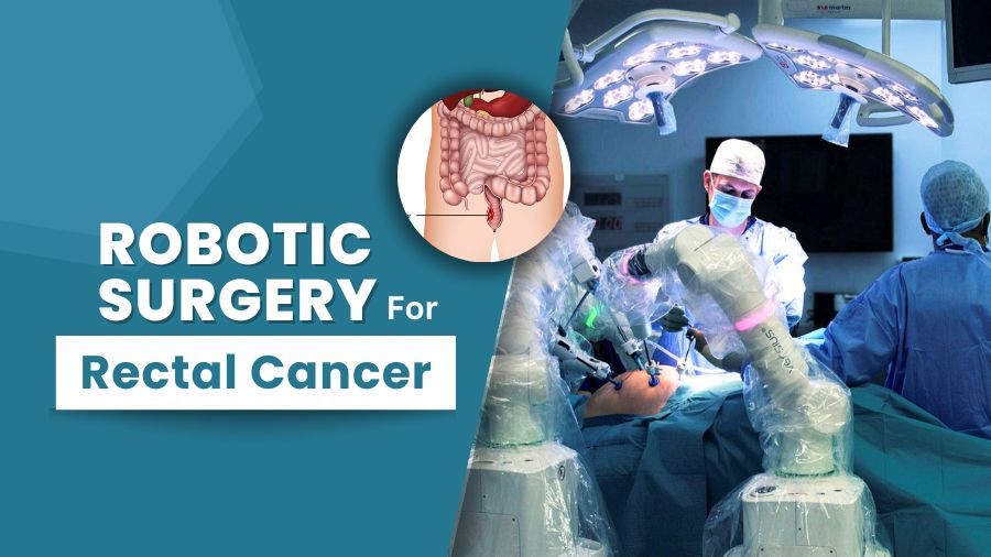 roboticsurgeryforrectalcancer3.jpg