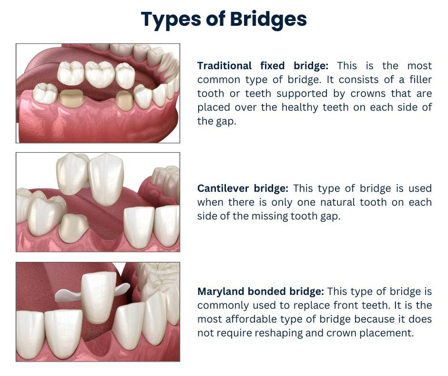 typesofbridges.jpg