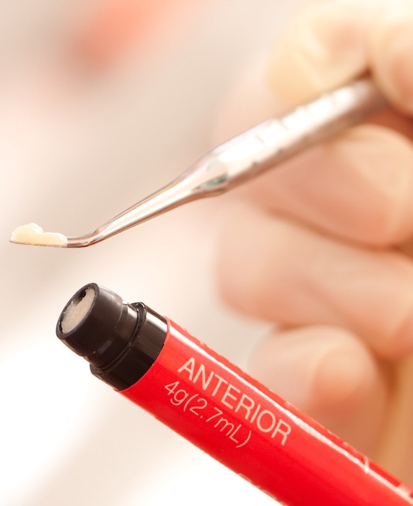 fillings_2.jpg