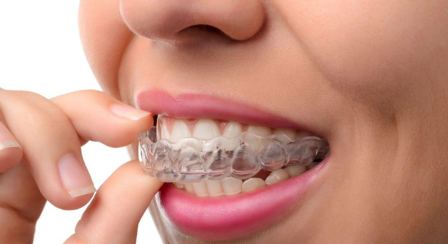 Teeth Straightening Specialist In Paschim Vihar– Get Your Smile Back