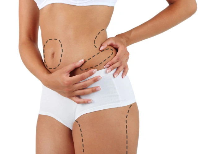 liposuctiontreatmentinnavimumbai_3_.jpg