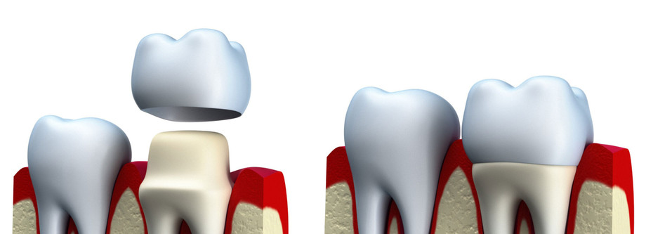 oral1scaled.jpg