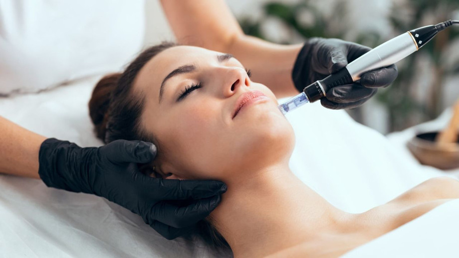 microneedlingtreatment.jpg