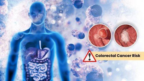 understandingcolorectalcancer480x270.jpg