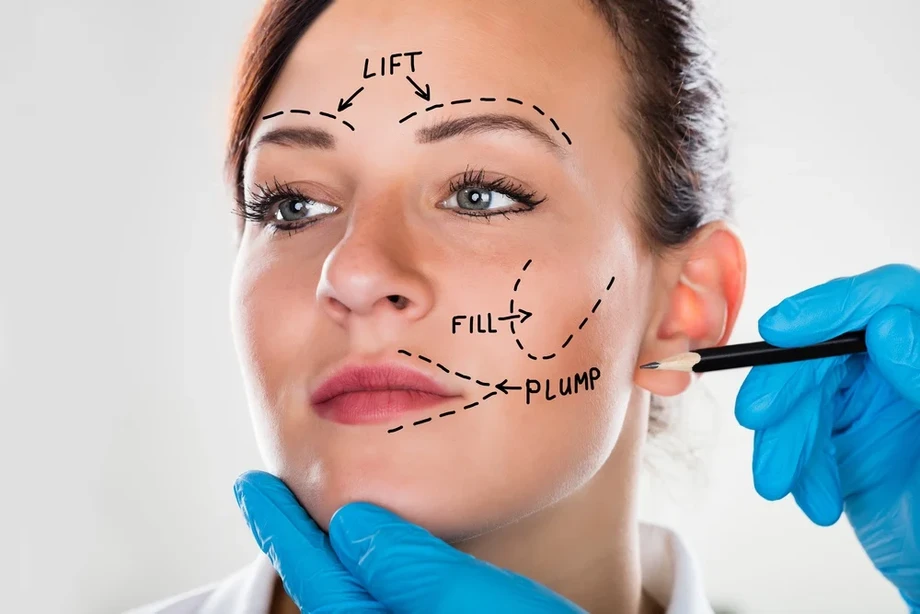 faceliftsurgery.webp