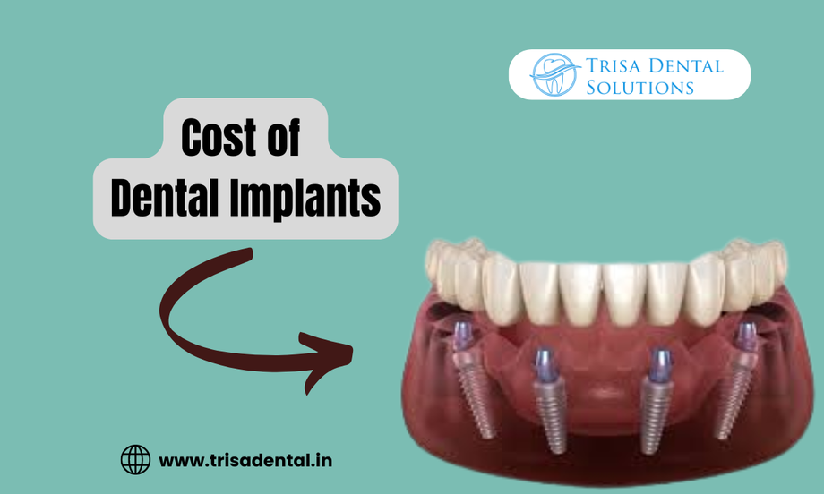 trisadentalsolutionscostofdentalimplants.png