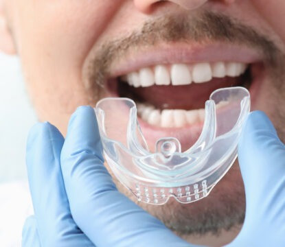 imgi_25_mouthguards415x360.jpeg