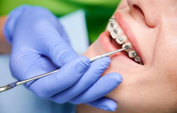 bracesforaperfectsmileinspokane.jpg