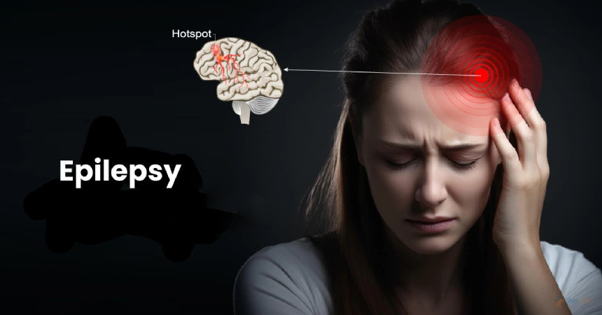 bestepilepsyspecialistinmumbai.jpg