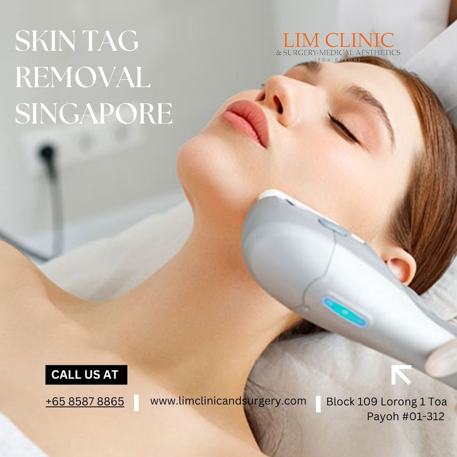 skintagremovalsingaporepolyclinic.jpg