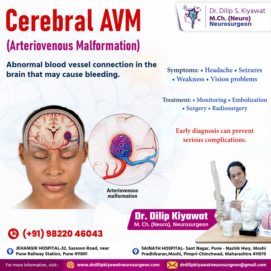 cerebralavmtreatmentpunedrdilipskiyawatjpg.jpeg