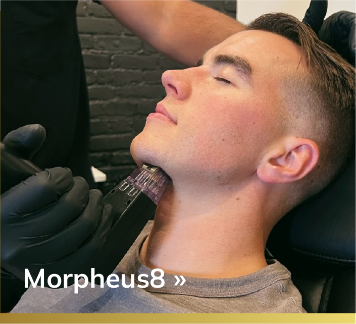 morpheus8hover.png