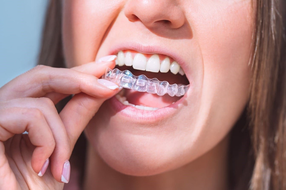 dentistnearmeofferinginvisalign.jpg
