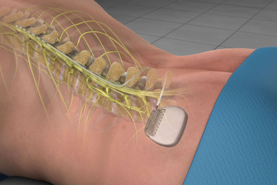 spinefusion.jpg