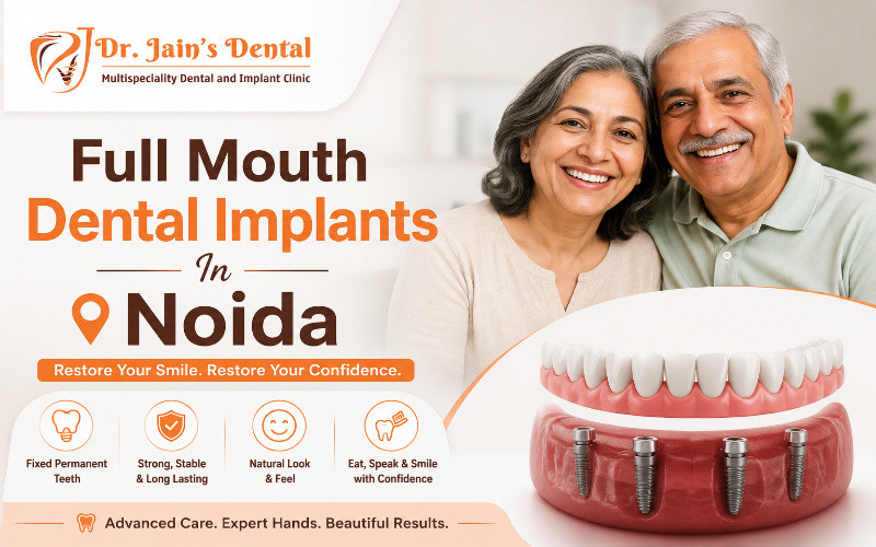 fullmouthdentalimplantsinnoida.jpeg