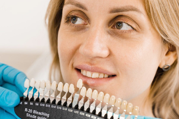 dentalveneers.jpg