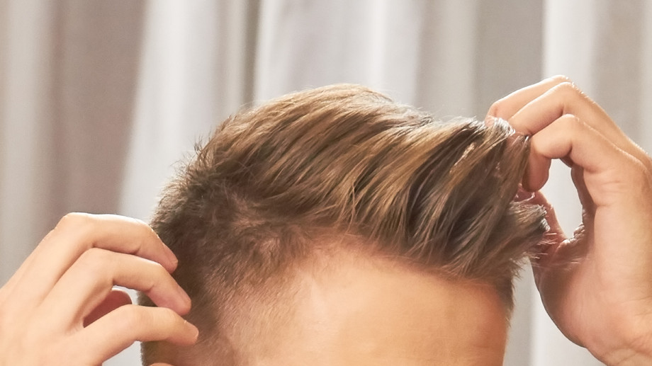 fhairline.jpg