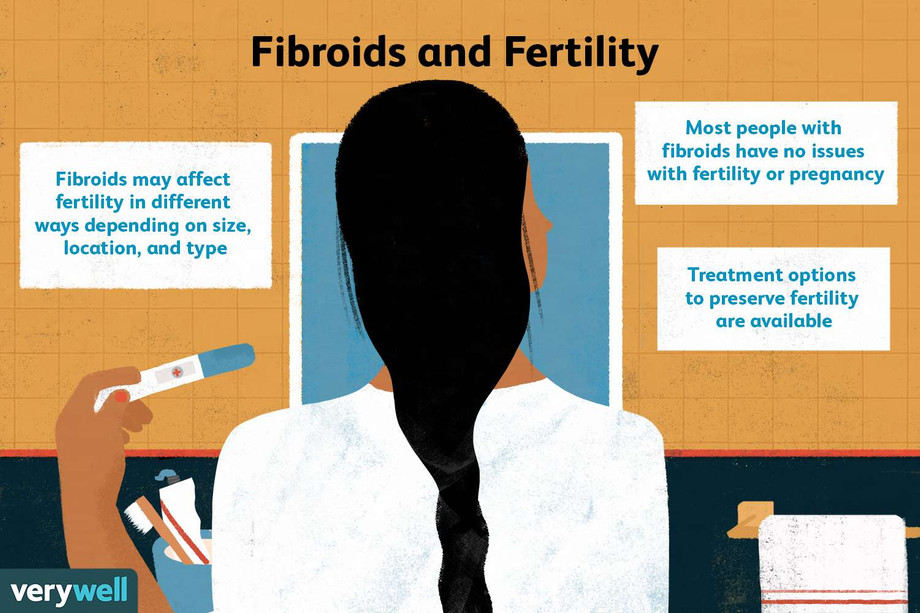 fibroidsinfertility.jpg