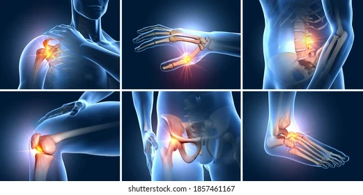 jointsetsixpainfuljointsmedical260nw1857461167.webp