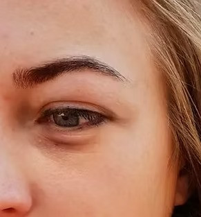 imgi_5_eyepuffeness1.jpeg