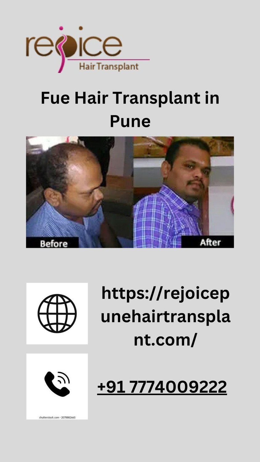 fuehairtransplantinpune.jpg