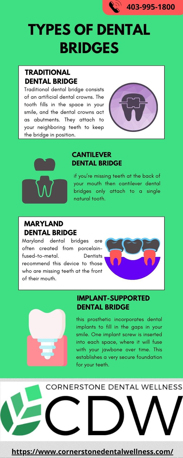 typesofdentalbridgescornerstonedentalwellness.jpg