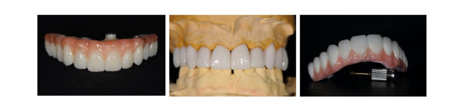 denturerepairsmelbourne.jpg